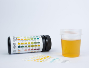 Uncomplicated urinary tract infection support